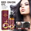 OUHOE Onion Essential Oil, Strengthens And Hydrates Hair Dense Hair Care Spray