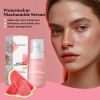 Watermelons Niacinamide Serum, Dilute Spots Firming Haun White Skin Hydrating Moisture Essence