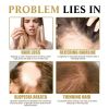West&Month Hair Boost Darken Strengthen Essence, Scalp Massage Moisturizing Hair Roots Thick Smooth Hair Care Ball