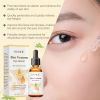 OUHOE Bee Venom Eye Serum Gently Moisturizes And Protects Skin Eye Daily Care Serum